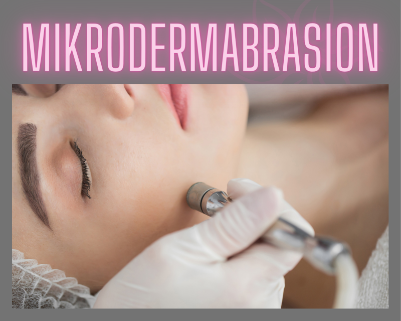 Mikrodermabrasion