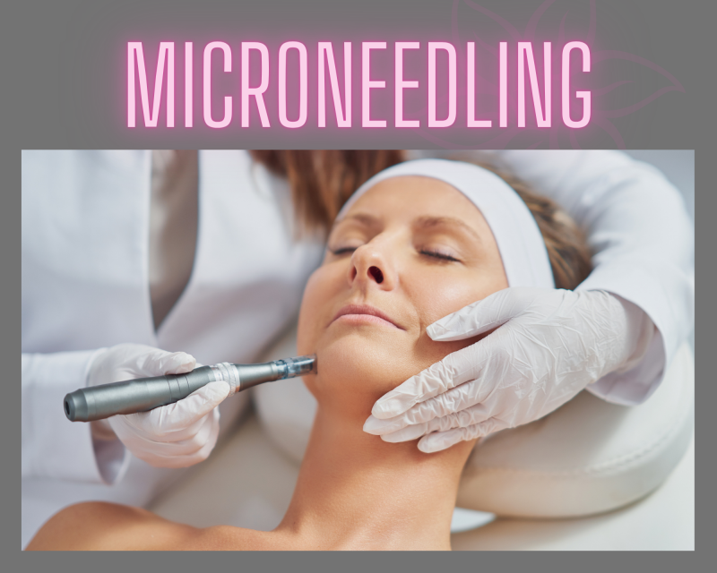 Microneedling